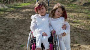 About Childhood SSI Benefits